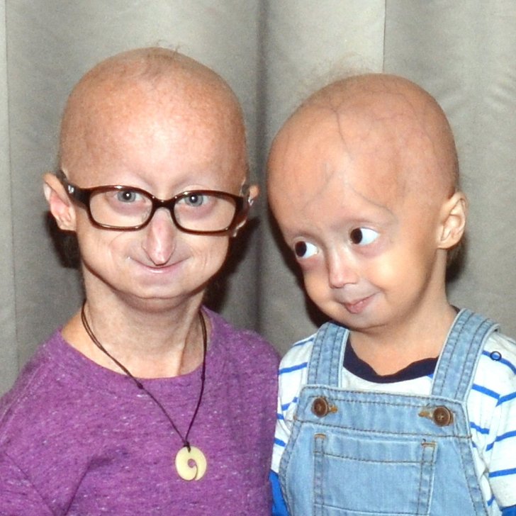 1.-Progeria-FAQs-square