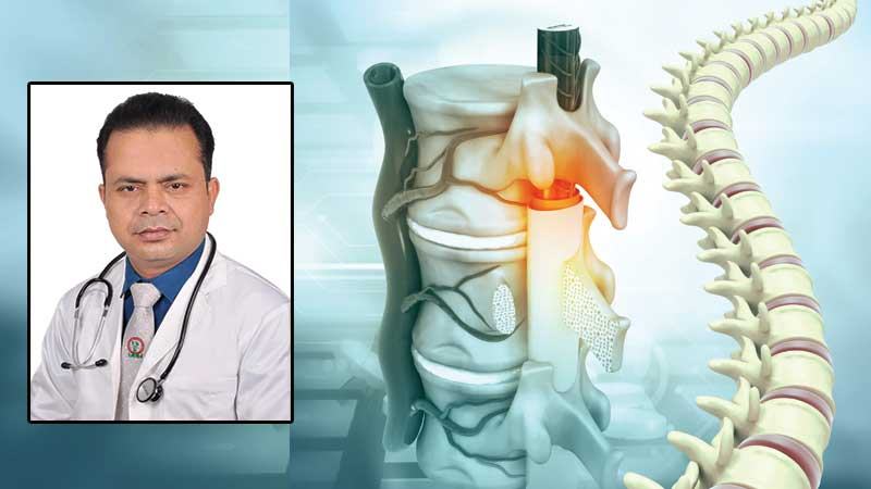 মেরুদণ্ডের রোগ স্কোলিওসিস চিকিৎসা কী?