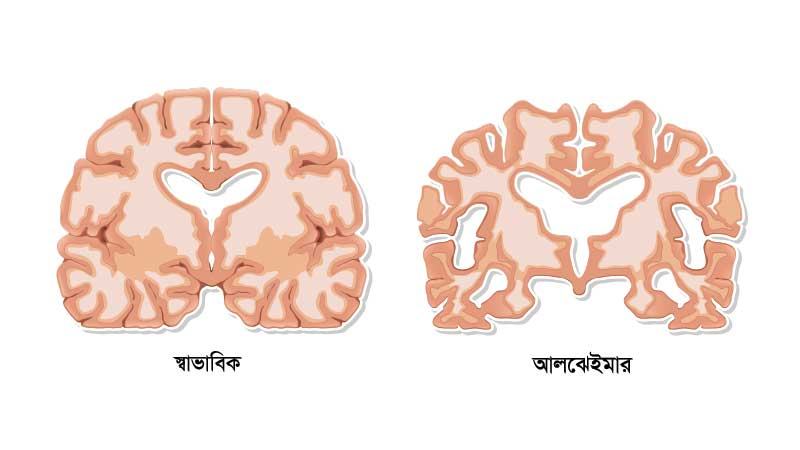 প্রতিরোধে করণীয়