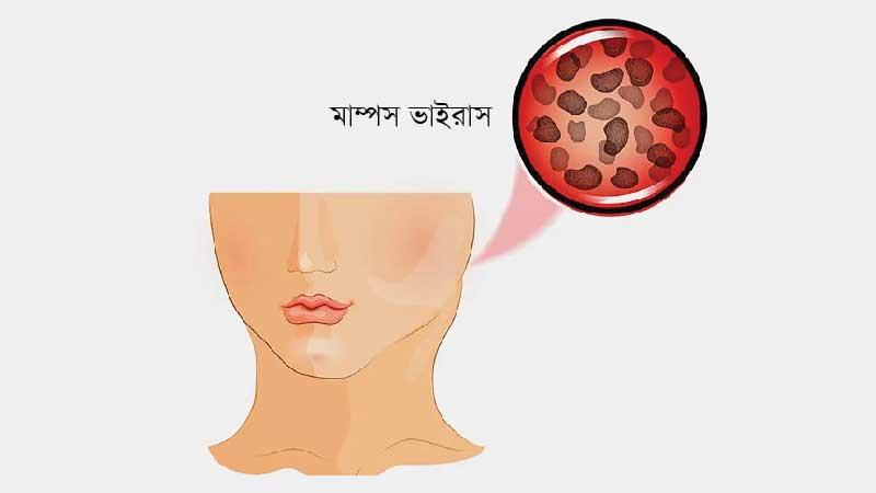 প্রাপ্তবয়স্করাও আক্রান্ত হতে পারে