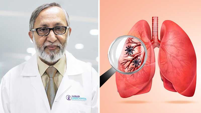 ৪০ শতাংশের বেশি ফুসফুস ক্যান্সার ধরা পড়ে শেষ পর্যায়ে