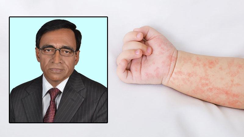 রুবেলা প্রতিরোধে টিকা গ্রহণ জরুরি