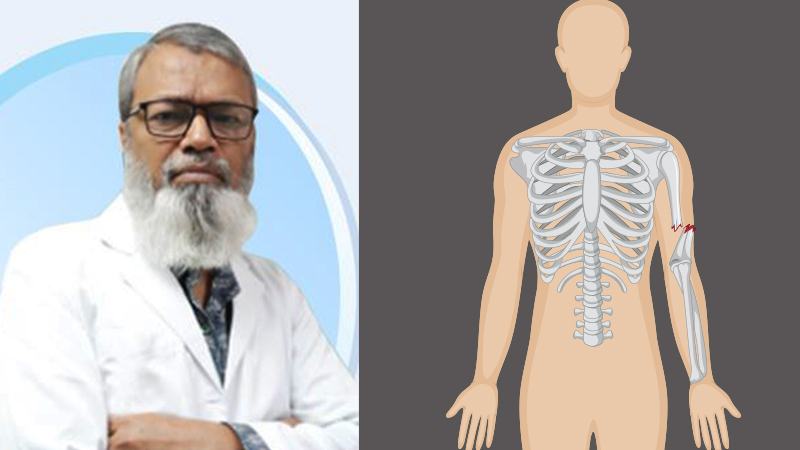 হাড় ভাঙায় করণীয় কী কখন অস্ত্রোপচার জরুরি