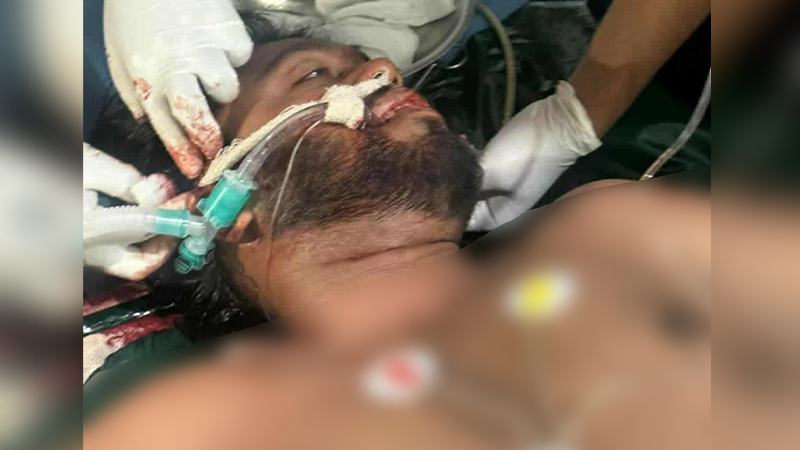 ওসমান হাদি ‘লাইফ সাপোর্টে’, ব্রেইনে প্রচুর রক্তক্ষরণ: চিকিৎসক