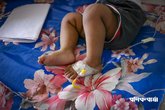 dengue_child_patient_KSR_15062025_03