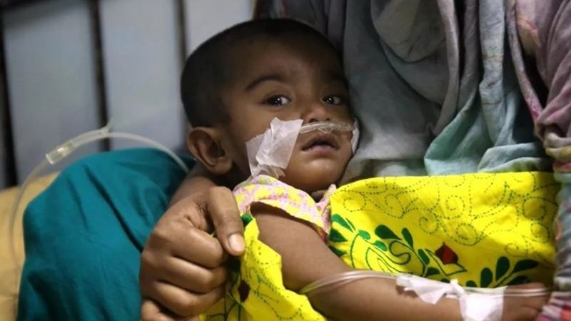 হামের উপসর্গে আরো ৩ শিশুর মৃত্যু