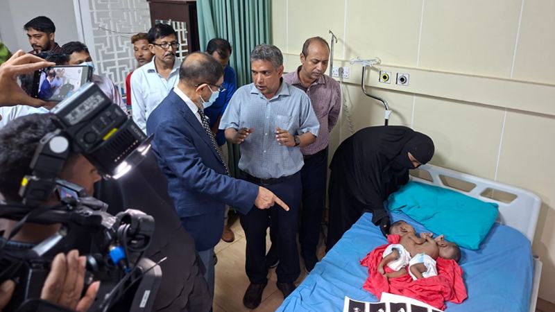 জোড়া লাগা দুই শিশুর চিকিৎসার দায়িত্ব নিয়েছে সরকার