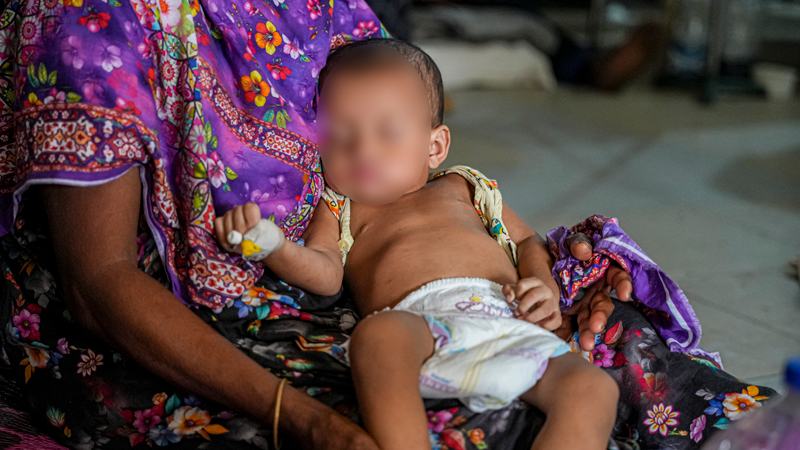 হামের উপসর্গে মারা গেছে আরো ৫ শিশু, মৃত্যু ছাড়াল ১২শ