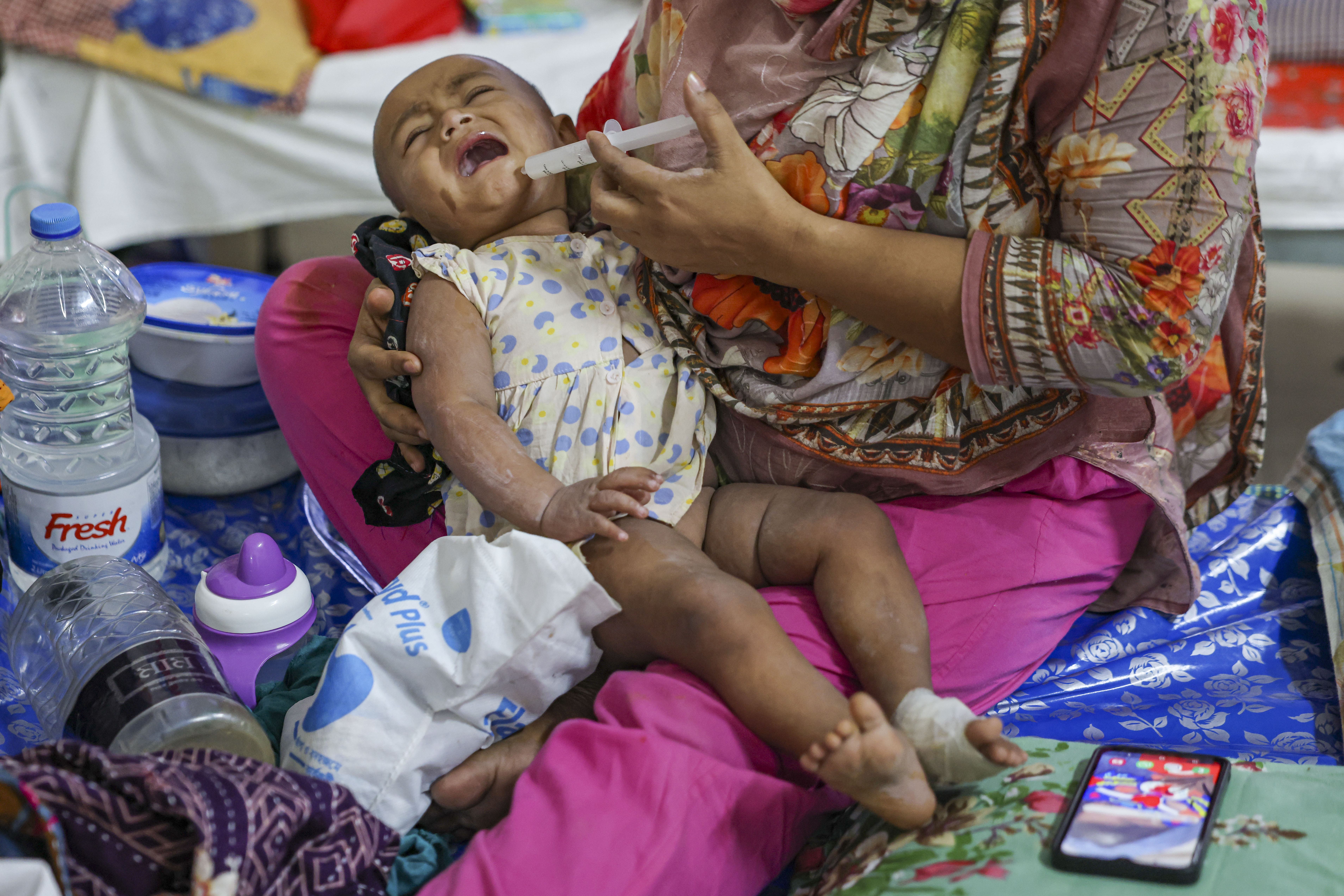 হাম উপসর্গে আরো এক শিশুর মৃত্যু, হাসপাতালে ভর্তি ৯৩৪