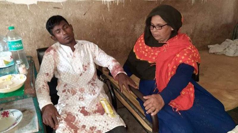 ইউপি উপ-নির্বাচনে স্বতন্ত্র প্রার্থীর সমর্থকদের উপর হামলা