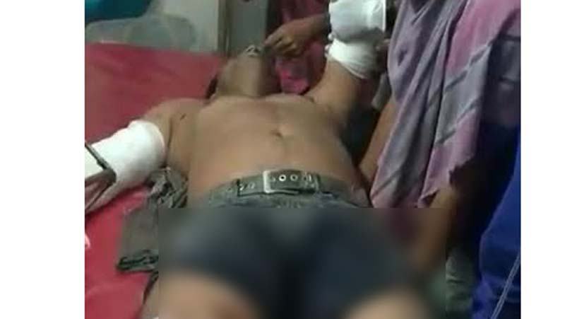 পটুয়াখালীতে কুপিয়ে শ্রমিক লীগ নেতার হাতের কব্জি বিচ্ছিন্ন