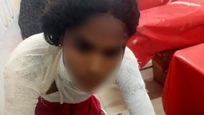 লক্ষ্মীপুরে গৃহবধুর গায়ে আগুন দিয়ে হত্যার চেষ্টা
