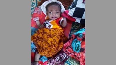 কুষ্টিয়ায় দেড় মাস বয়সী শিশু কভিডে আক্রান্ত