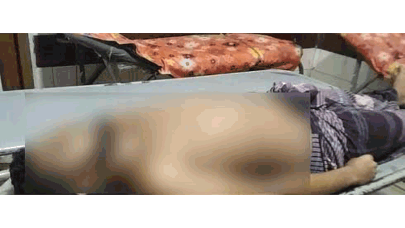 ভুল চিকিৎসায় শিক্ষার্থীর মৃত্যুর অভিযোগ