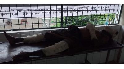 কুষ্টিয়ায় বোমা বানাতে গিয়ে আহত কারিগরের মৃত্যু