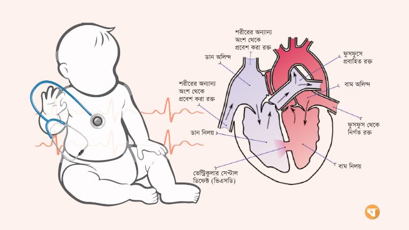 যথাসময়ে চিকিৎসায় নির্মূল সম্ভব