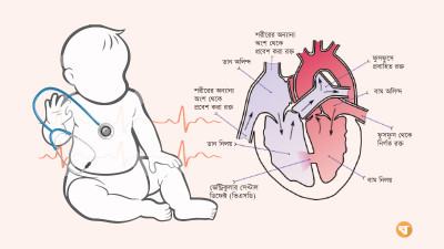 যথাসময়ে চিকিৎসায় নির্মূল সম্ভব