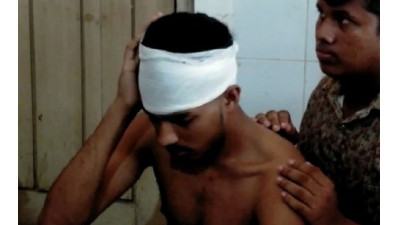 নড়াইলে এসএসসি পরীক্ষার্থীকে কুপিয়ে জখম