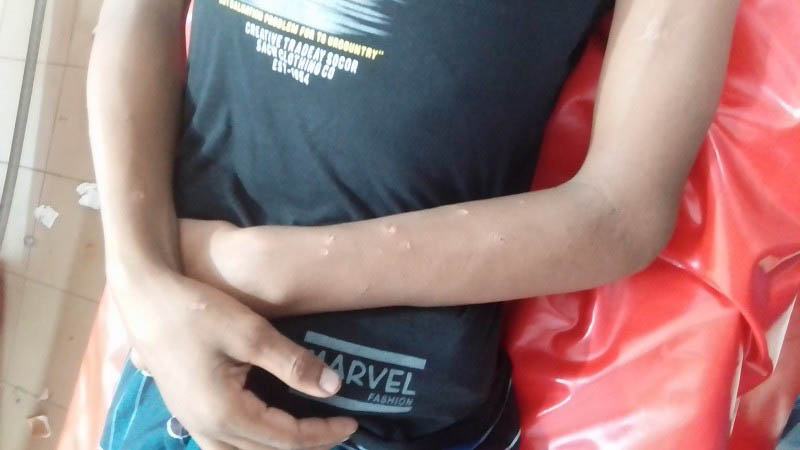 লক্ষ্মীপুরে শিশু নির্যাতনের অভিযোগ