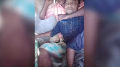মিয়ানমার সীমান্তে মাইন বিস্ফোরণে পা হারালেন বাংলাদেশী