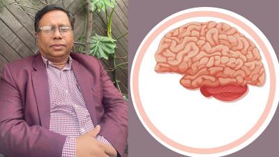 স্ট্রোক প্রতিরোধে মানুষের ইচ্ছাশক্তি বড় ভূমিকা পালন করে