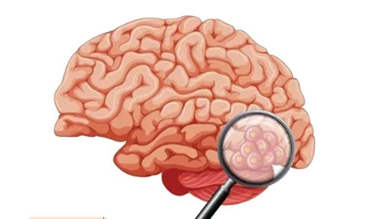 অস্ত্রোপচার-পরবর্তী অবস্থা...