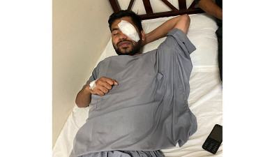 'পুলিশ দুই হাত তুলে পেছনে যেতে বলে আকস্মিক গুলি চালায়'