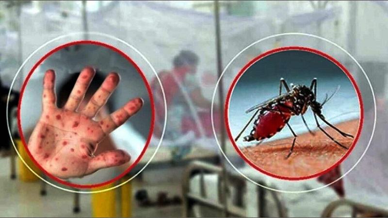 ফেনীতে বাড়ছে হামের প্রকোপ, ডেঙ্গু আক্রান্তের সংখ্যা ছাড়াল গত বছরের রেকর্ড